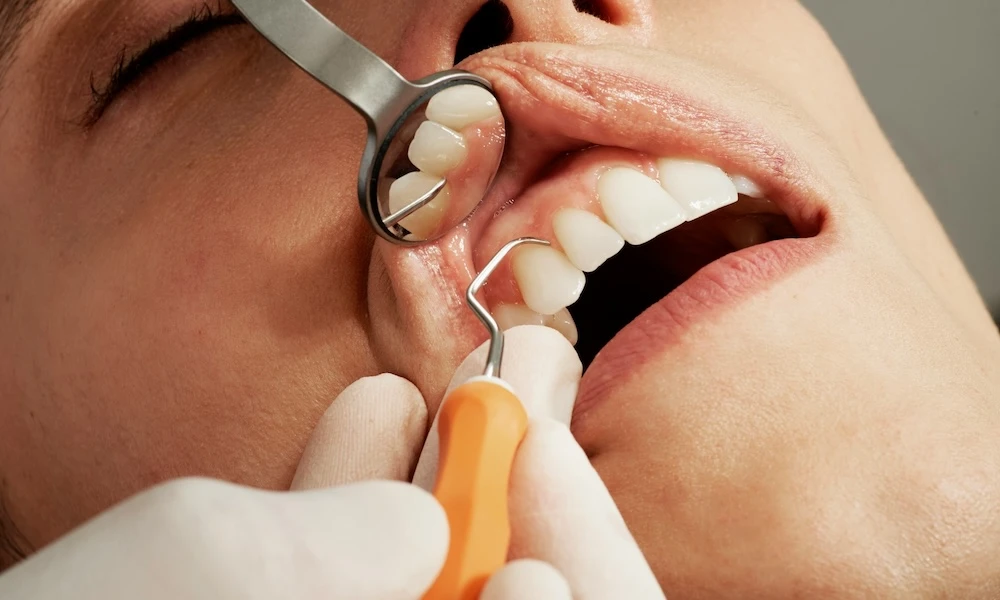 Photo of Dentist and dental nurse doing dental treatment on patient